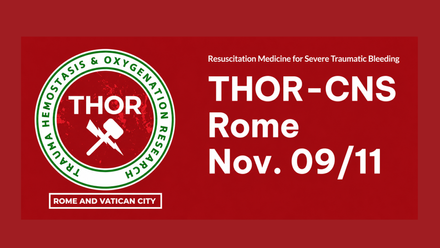 Thor-CNS_460x213.png